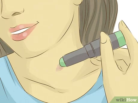 3 Ways to Remove a Hickey - wikiHow
